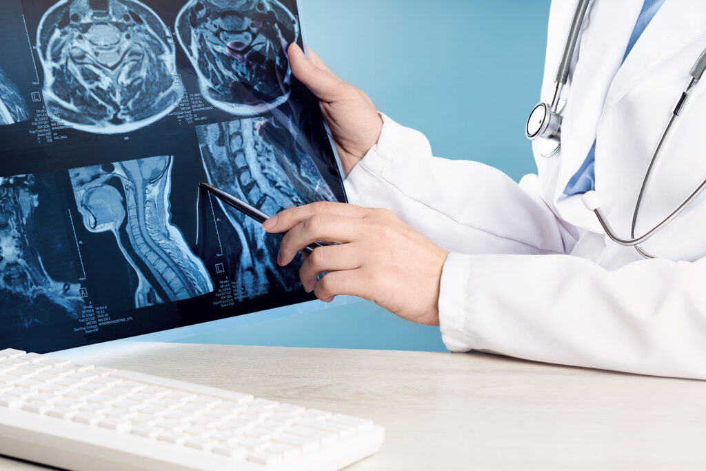 doctors hands holding x-ray or MRI medical imaging with a head and neck condition.