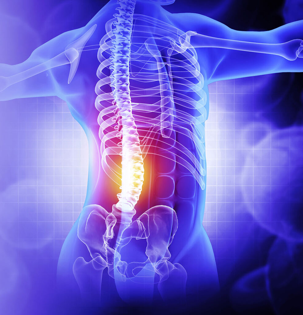 Pain in the spine,