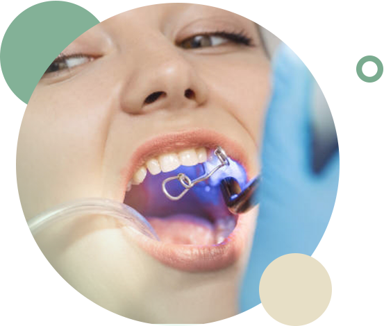 dental bonding smyrna ga